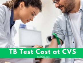 How Much is TB Test at CVS