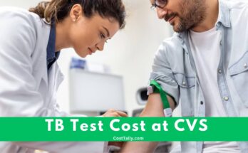 How Much is TB Test at CVS