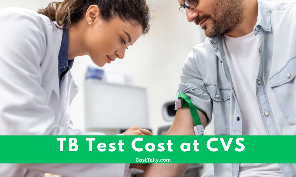 How Much is TB Test at CVS